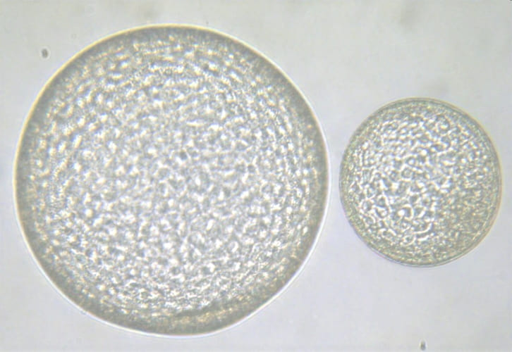 Embryo Transfer - Lectures